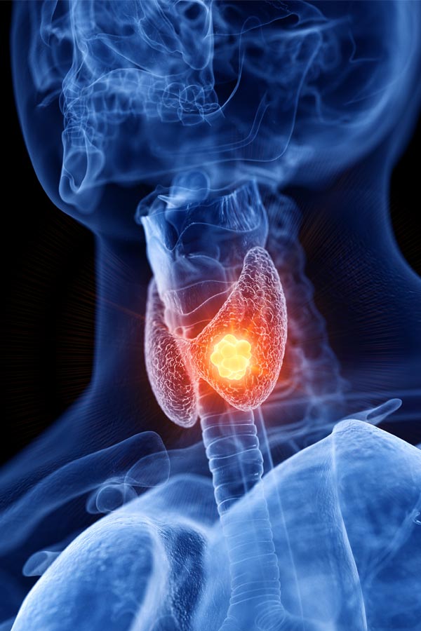 Thyroid-Treatment-East-Bay-Area-Audra-Foster Thyroid Treatment East Bay Area Audra Foster